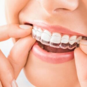 White Orchid Dental & Wellbeing Clinic for our Invisalign Open Day